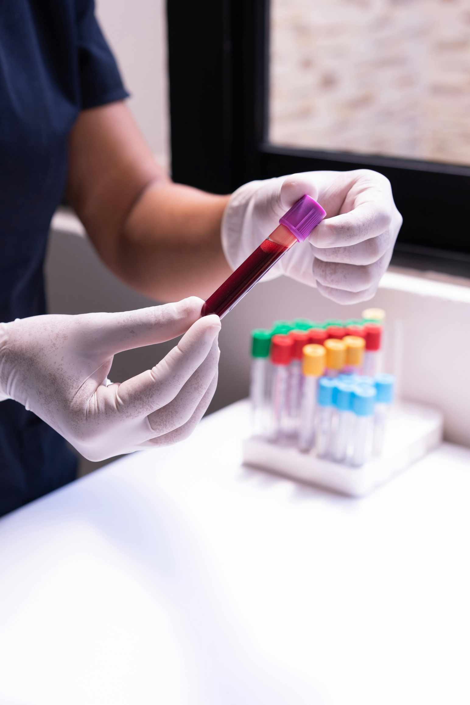 Lab results